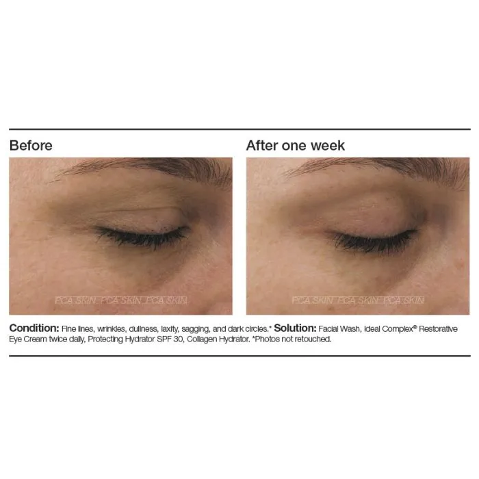 PCA Skin Ideal Complex® Restorative Eye Cream